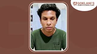 20 Years Old Patient Got Rid Of Acne | Patient Testimonial | Acne Scars Treatment | Dr Mayur Goklani