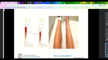 NỘI CƠ SỞ 2 CTUMP: TRIỆU CHỨNG LÂM SÀNG HỆ CƠ XƯƠNG KHỚP| THS HUỲNH THANH HIỀN