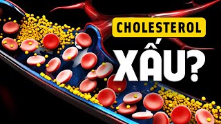 #790 Thông Não Cholesterol: Có Xấu Như Lời Đồn?