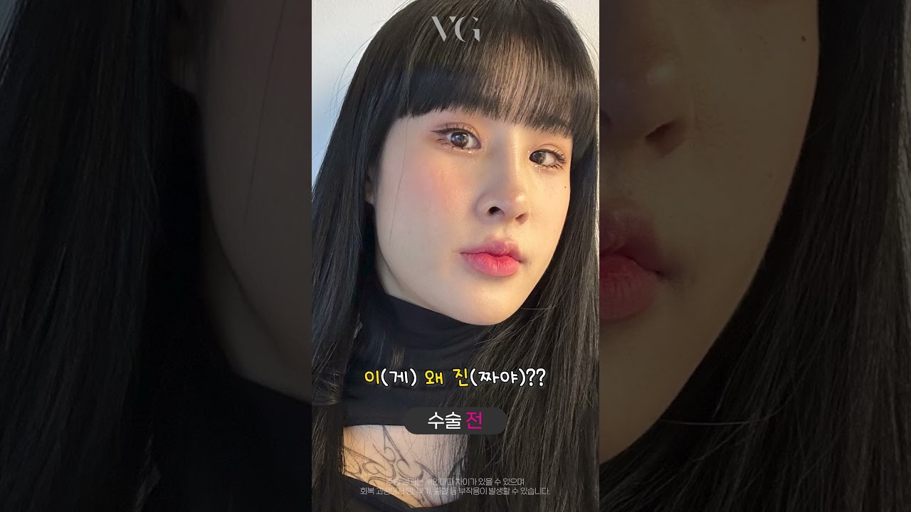 [貝麗古德整形外科診所] 輪廓三項 真的是 #goodthing