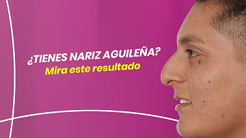 ¿Qué etnias tienen nariz aguileña?