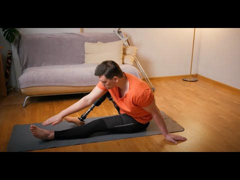 Episode 3 - Becoming an Amputee. Where to from here?