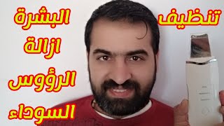 تنظيف البشرة وازالة الرؤوس السوداء | تنظيف البشرة بعمق بجهاز الالتراسونيك البشرة تنظيف_البشره