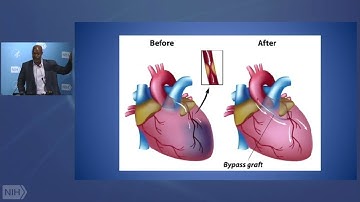 WALS- Towards Preventative Psychotherapeutics