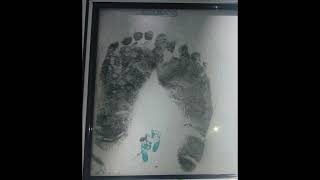 ANONYMOUS | In Memory of Ozzlynn Alexis Ann Patrick