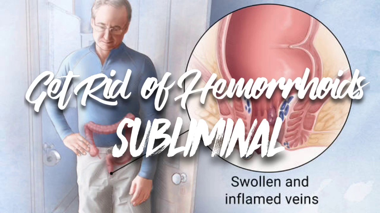 Get Rid of Hemorrhoids | Subliminal
