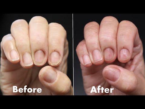 Video: 3 manieren om de huid op natuurlijke wijze te bleken