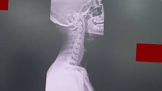 Lil Aungpao X Artrilla - กอนไป Prod. Nextlane