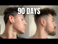 How to grow a beard in 90 days using minoxidil  derma roller