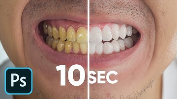 Whiten Teeth in 10 Seconds! (No Clickbait)