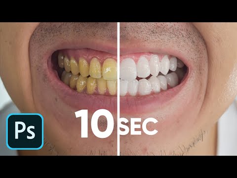 Whiten Teeth in 10 Seconds! (No Clickbait)