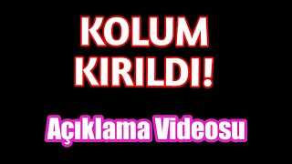 Kolum Kırıldı. Açıklama Videosu (Neden Video Gelmedi? , Yeni Video Düzeni)