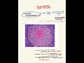 Granuloma formation [chronic information ] general pathology￼