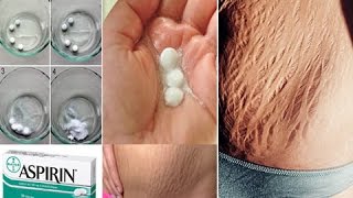 Elimina R�pidamente Las Estr�as Con Aspirina, Los Resultados No Los Podr�s Creer | Mejor Salud