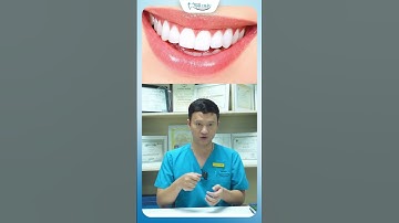 4 Phương Pháp Giúp Răng Trắng Sáng Tại Nhà | Bác Sĩ Yên