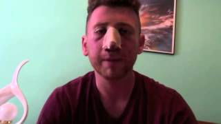 My Surgical Journey: Alex K.: Day 2, A Septorhinoplasty Diary of Top ENT Dr. Robert Guida's Patient Wealth