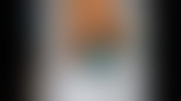 Robotic left lateral hepatectomy for hepatocellular carcinoma. Unedited (4X speed).