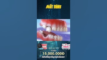 [3D] MẤT RĂNG || Nha Khoa Quốc Tế Athena