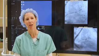 TWH - WATCHMAN Procedure