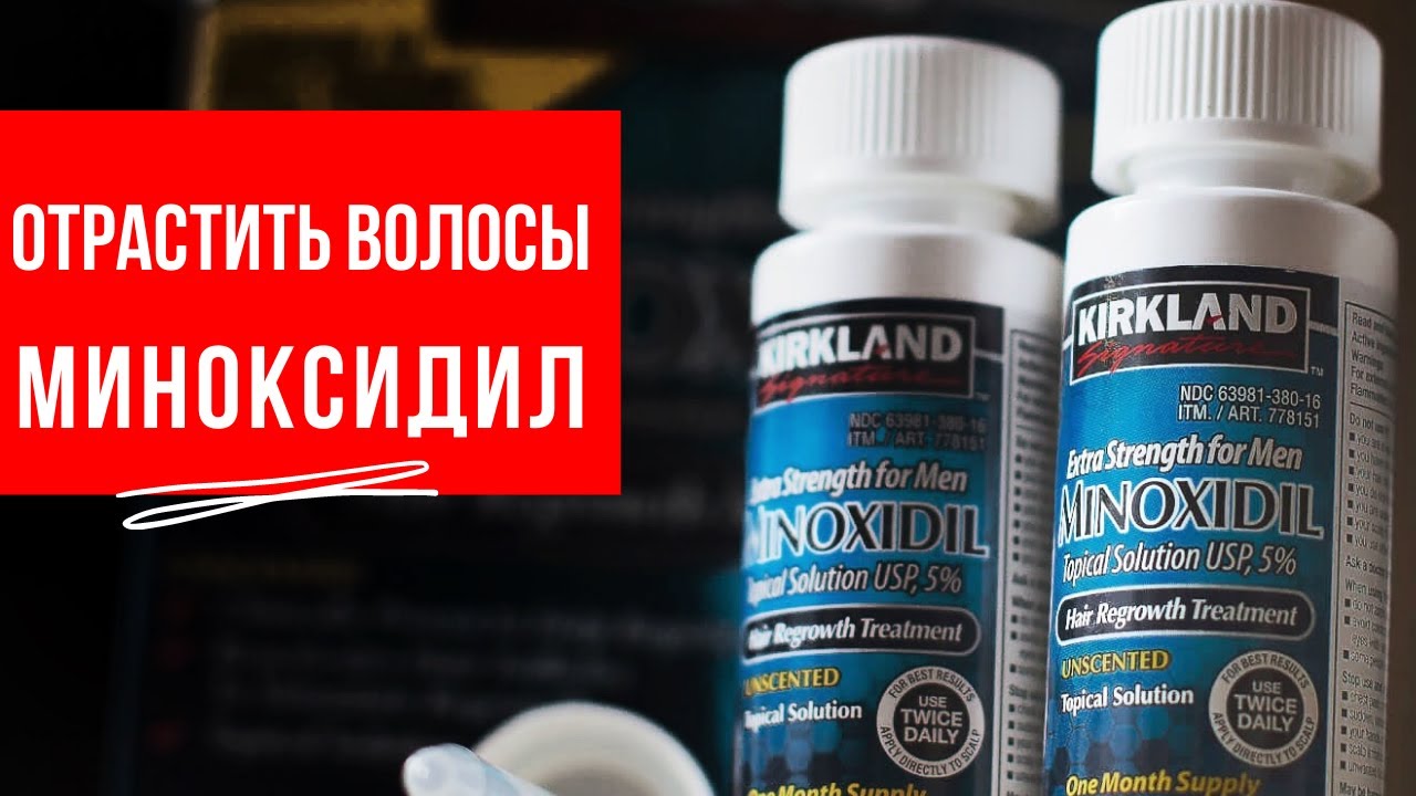 ОБЛЫСЕНИЕ. Как отрастить волосы? МИНОКСИДИЛ - Arsen Dekusar studio ...