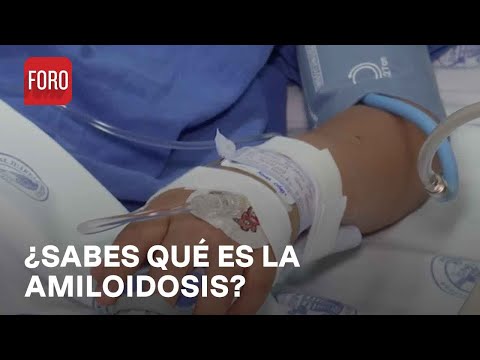 Video: ¿Qué amiloidosis es hereditaria?