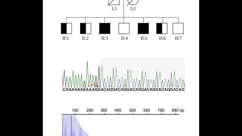 A novel RFC1 repeat motif (ACAGG) in two Asia-Pacific CANVAS families