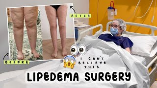 My Final Life Changing Surgery - I Can't Believe The Results 😳 Lipedema and Me ep.4 ad by Gabriella ♡ 60,691 views 3 months ago 22 minutes