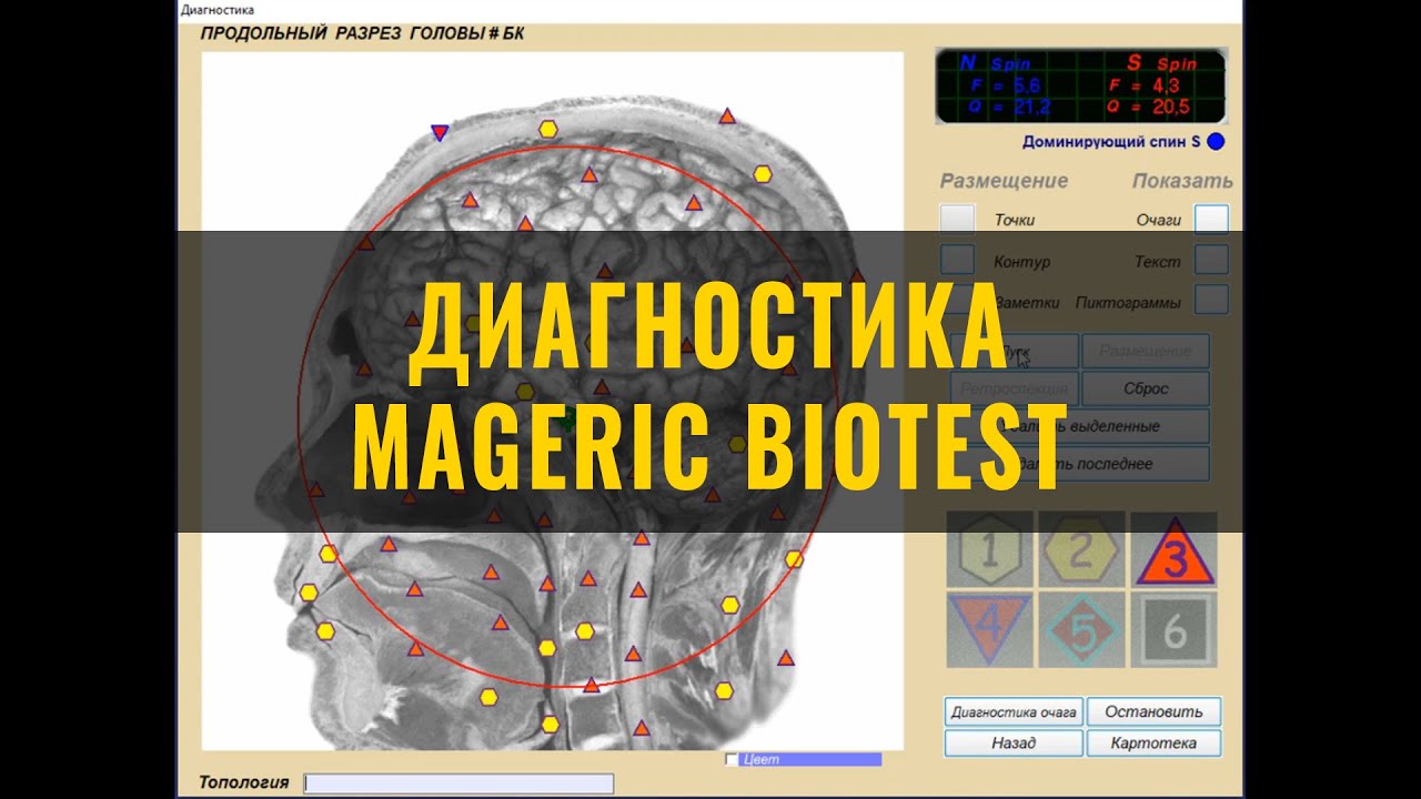 Биорезонансная диагностика организма Mageric обман, развод, лохотрон ...