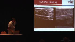 B-Mode Ultrasound Imaging for Studying Human Muscle Mechanics