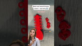 Best Braces Colors-Red Before and After