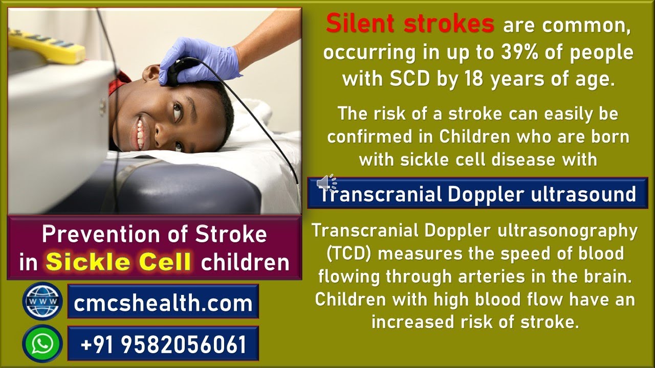 Prevention of stroke in sickle cell disease children CMCS Health - YouTube