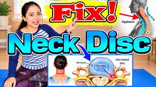 C6-C7 Neck Pain & Weakness? These Gentle Herniated Disc Exercises May Surprise You!