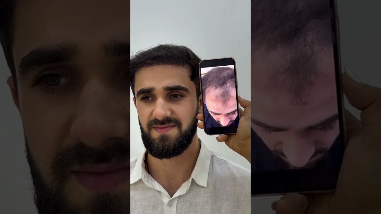 Video Önizləmə