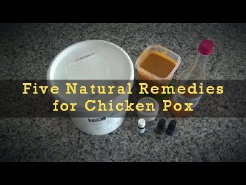 My Five Natural Remedies for Chicken Pox