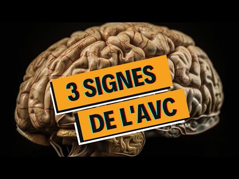 Les 3 signes
