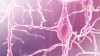 Alzheimers