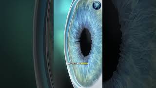 “Eye Lens Explained | Cataract Surgery &amp; Vision Restoration 👁️✨” #healthtips #doctoradvice #doctor