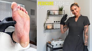 Restoring Heavily Worn Damaged Feet Back To Life