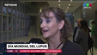 Dìa mundial del Lupus: una enfermedad autoinmune que afecta a 28 mil argentinos
