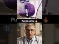 Purple Urine Bag Syndrome | Best app for NEET PG Preparation |Dopamine|