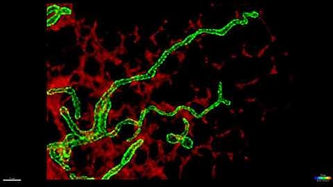 Super-resolution (STED) imaging of mitochondria and ER in fibroblasts