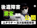 【後遺障害認定の「闇」暴露！】後遺障害（後遺症）認定の仕組みを、正しく理解。第２弾（後編）では、後遺障害の等級を判断する「認定基準」について、わかりやすく解説します。