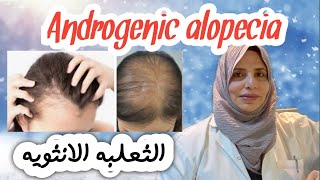 Androgenic alopecia الثعلبه الانثويه تشخيصها وكيفيه علاجها ؟؟