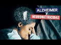 Alzheimer y Neuromotricidad