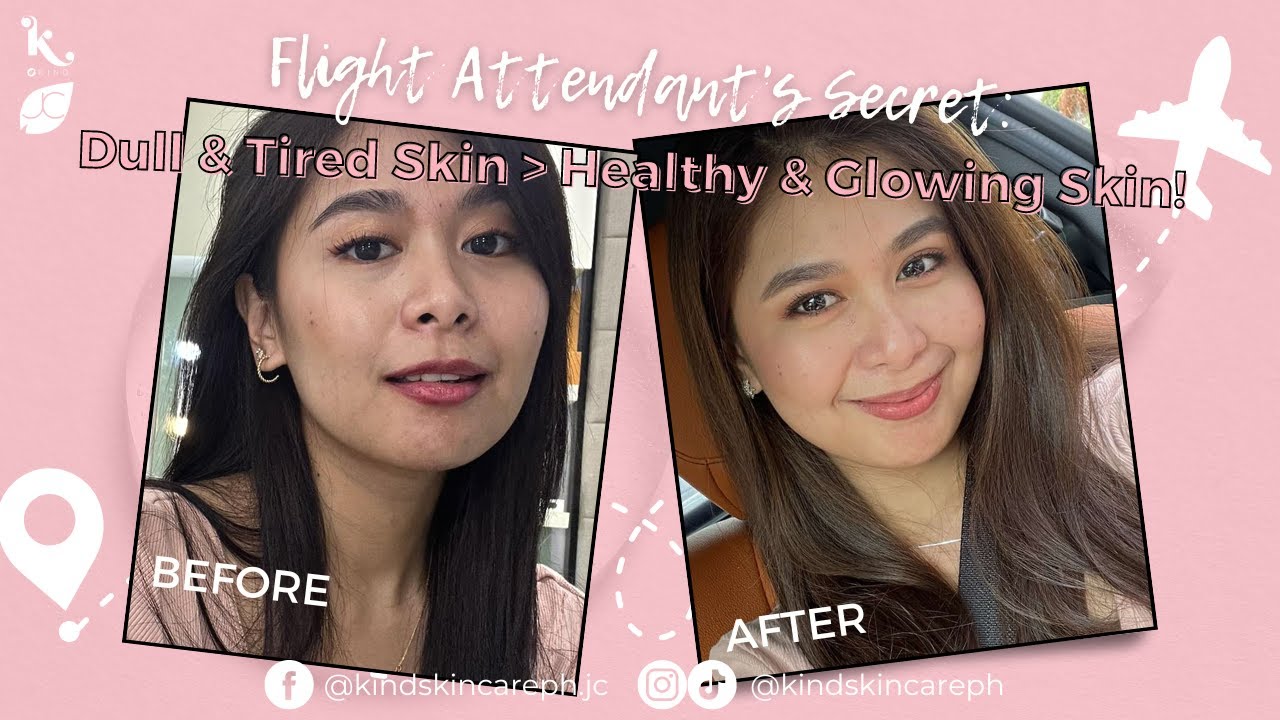 BYE BYE, DULL & DRY SKIN! | Kind Skincare Testimonial
