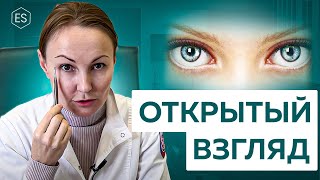 видео: 👁 Как сделать ВЗГЛЯД ОТКРЫТЫМ? Почему ОПУСКАЮТСЯ ВЕКИ на глаза? ЭНДОСКОПИЯ или ПЛАСТИКА ВЕРХНИХ ВЕК? картинка: 👁 Как сделать ВЗГЛЯД ОТКРЫТЫМ? Почему ОПУСКАЮТСЯ ВЕКИ на глаза? ЭНДОСКОПИЯ или ПЛАСТИКА ВЕРХНИХ ВЕК?