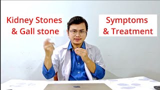 kidney & gall stones' Treatment & symptoms | #gallstonetreatment #kidneystone