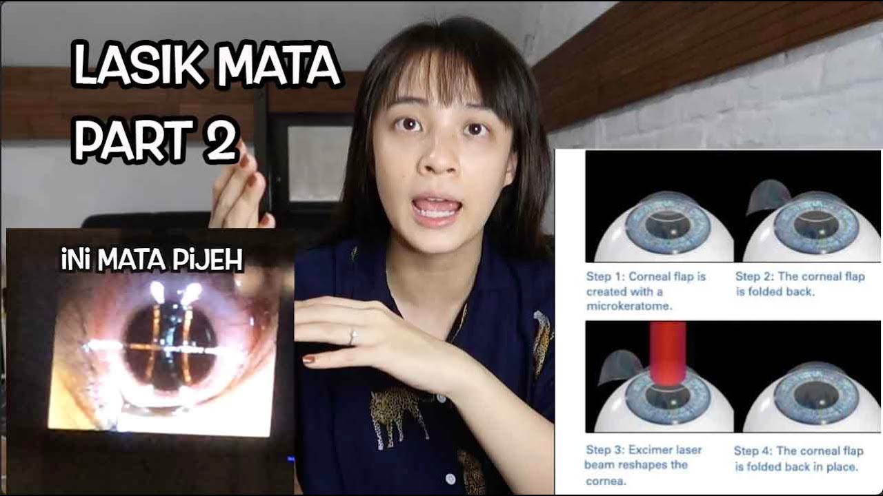 ABIS LASIK MATA LANGSUNG BISA BACA NOMOR PLAT MOBIL DEPAN