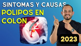 Pólipos Síntomas, Causas, Diagnostico Y Tratamiento Dr Juan Pablo Hernández Parte 1