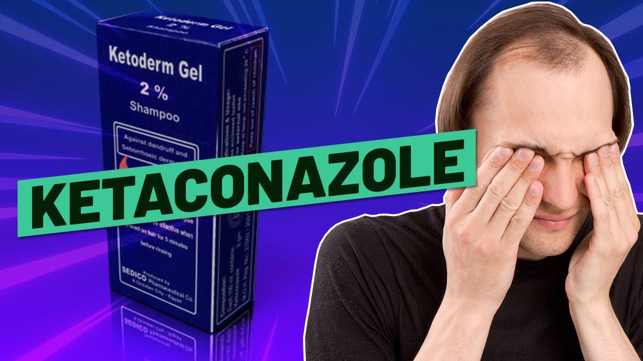 Ketaconazole Shampoo for Hair Growth - Works Like Crazy!